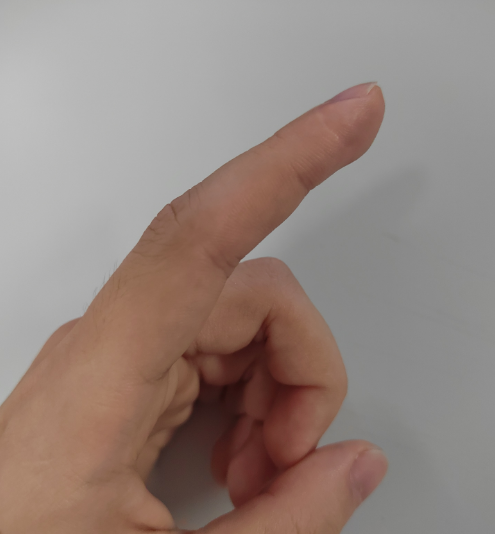 真正有效的祛疤办法，首先要这样做！